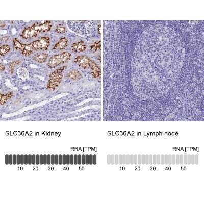 Immunohistochemistry-Paraffin: SLC36A2 Antibody [NBP1-92401] - Staining in human kidney and lymph node tissues using anti-SLC36A2 antibody. Corresponding SLC36A2 RNA-seq data are presented for the same tissues.