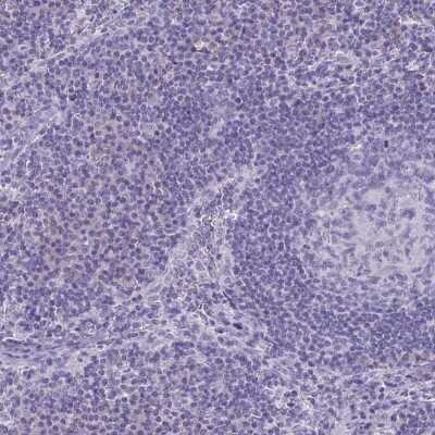 Immunohistochemistry-Paraffin: SLC36A2 Antibody [NBP2-49360] - Staining of human lymph node shows low expression as expected.