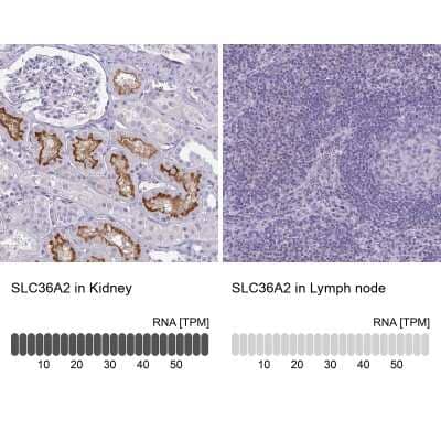 <b>Orthogonal Strategies Validation. </b>Immunohistochemistry-Paraffin: SLC36A2 Antibody [NBP2-49360] - Staining in human kidney and lymph node tissues using anti-SLC36A2 antibody. Corresponding SLC36A2 RNA-seq data are presented for the same tissues.