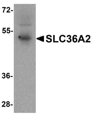 Western Blot: SLC36A2 Antibody [NBP2-81904] - Western blot analysis of SLC36A2 in human stomach tissue lysate with SLC36A2 antibody at1 ug/ml.