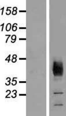 Western Blot: SLC36A2 Overexpression Lysate (Adult Normal) [NBP2-04892] Left-Empty vector transfected control cell lysate (HEK293 cell lysate); Right -Over-expression Lysate for SLC36A2.