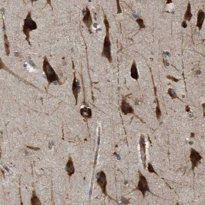 Immunohistochemistry-Paraffin SLC36A4 Antibody