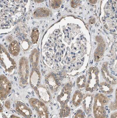 Immunohistochemistry-Paraffin SLC36A4 Antibody