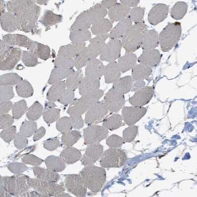 Immunohistochemistry-Paraffin: SLC36A4 Antibody [NBP1-81931] - Staining of human skeletal muscle shows no cytoplasmic positivity in myocytes as expected.