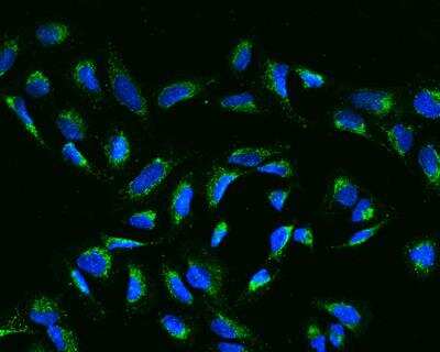 Immunocytochemistry/Immunofluorescence: SLC37A3 Antibody [NBP3-12693] - Staining of SLC37A3 in U2OS cells. Cells were fixed with 4% PFA, permeabilzed with 0.3% Triton X-100 in PBS,blocked with 10% serum, and incubated with rabbit anti-Human SLC37A3 polyclonal antibody (dilution ratio 1:200) at 4? overnight. Then cells were stained with the Alexa Fluor®488-conjugated Goat Anti-rabbit IgG secondary antibody (green) and counterstained with DAPI (blue).Positive staining was localized to Cytoplasm.
