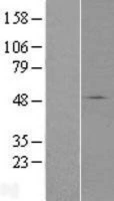 Western Blot: SLC37A3 Overexpression Lysate (Adult Normal) [NBP2-06051] Left-Empty vector transfected control cell lysate (HEK293 cell lysate); Right -Over-expression Lysate for SLC37A3.