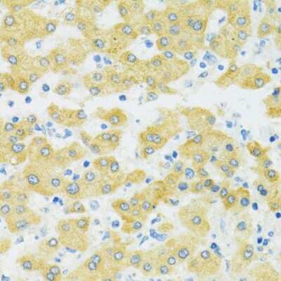 Immunohistochemistry-Paraffin: SLC37A4 Antibody [NBP2-93652] - Human liver using SLC37A4 antibody at dilution of 1:100 (40x lens).