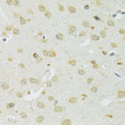 Immunohistochemistry-Paraffin: SLC37A4 Antibody [NBP2-93652] - Mouse brain using SLC37A4 antibody at dilution of 1:100 (40x lens).