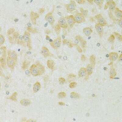 Immunohistochemistry-Paraffin: SLC37A4 Antibody [NBP2-93652] - Rat brain using SLC37A4 antibody at dilution of 1:100 (40x lens).