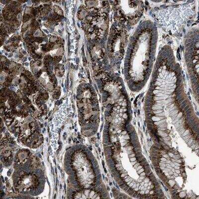 Immunohistochemistry SLC38A10 Antibody - BSA Free