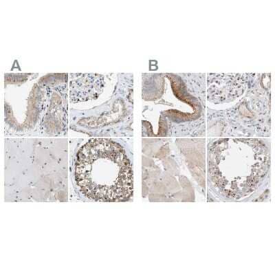 Immunohistochemistry-Paraffin SLC38A10 Antibody - BSA Free