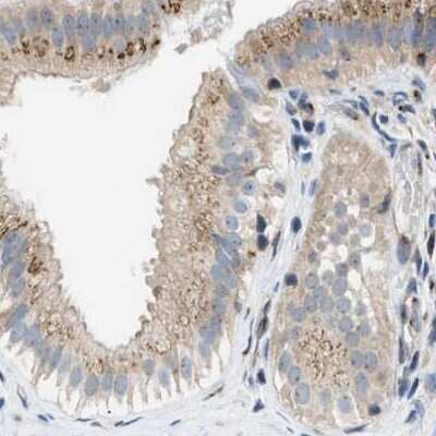 Immunohistochemistry-Paraffin SLC38A10 Antibody - BSA Free