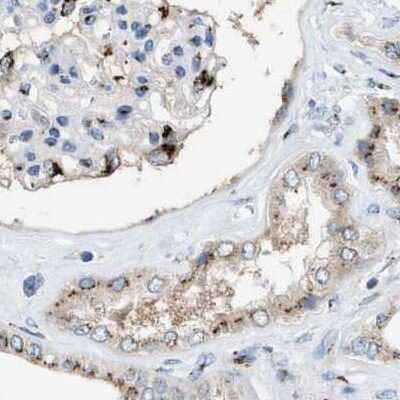 Immunohistochemistry-Paraffin SLC38A10 Antibody - BSA Free
