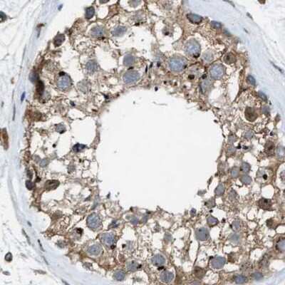 Immunohistochemistry-Paraffin SLC38A10 Antibody - BSA Free