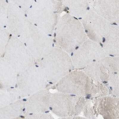 Immunohistochemistry-Paraffin SLC38A10 Antibody - BSA Free