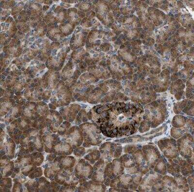 Immunohistochemistry-Paraffin SLC38A10 Antibody - BSA Free