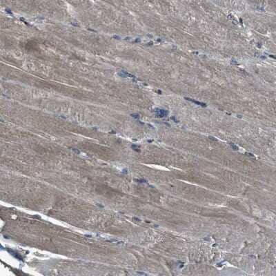 Immunohistochemistry-Paraffin SLC38A10 Antibody - BSA Free