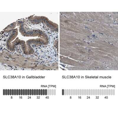 Immunohistochemistry-Paraffin SLC38A10 Antibody - BSA Free