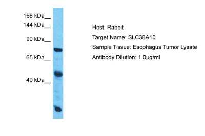 Western Blot: SLC38A10 Antibody [NBP2-88303] - Host: Rabbit. Target Name: SLC38A10. Sample Type: Esophagus Tumor lysates. Antibody Dilution: 1.0ug/ml