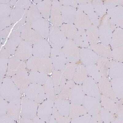 Immunohistochemistry-Paraffin SLC38A9 Antibody - BSA Free