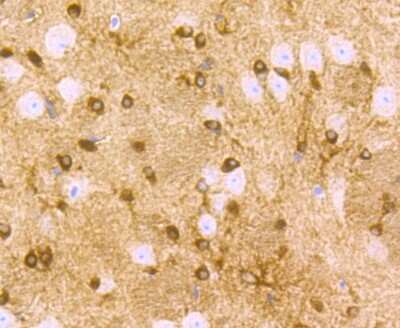 Immunohistochemistry-Paraffin: SLC39A12 Antibody [NBP2-75665] - Analysis of paraffin-embedded mouse brain tissue using anti-ZIP12 antibody. Counter stained with hematoxylin.