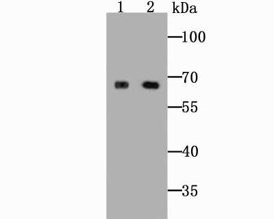 Western Blot: SLC39A12 Antibody [NBP2-75665] - Analysis of ZIP12 on HepG2 cell and rat lung tissue lysates using anti-ZIP12 antibody at 1/500 dilution.