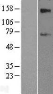 Western Blot: SLC39A12 Overexpression Lysate (Adult Normal) [NBL1-16142] Left-Empty vector transfected control cell lysate (HEK293 cell lysate); Right -Over-expression Lysate for SLC39A12.