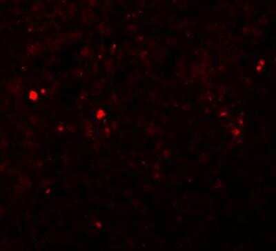 Immunocytochemistry/Immunofluorescence: SLC39A13 Antibody [NBP1-76509] - Immunofluorescence of ZIP13 in human spleen tissue with ZIP13 antibody at 20 ug/mL.