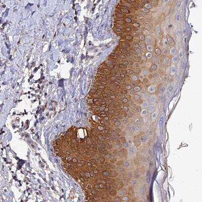 Immunohistochemistry-Paraffin: SLC39A13 Antibody [NBP1-92404] - Staining of human esophagus shows strong cytoplasmic positivity in basal layers of squamous epithelial cells.