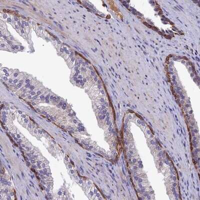 Immunohistochemistry-Paraffin: SLC39A13 Antibody [NBP1-92404] - Staining of human prostate shows strong cytoplasmic positivity in basal cells.