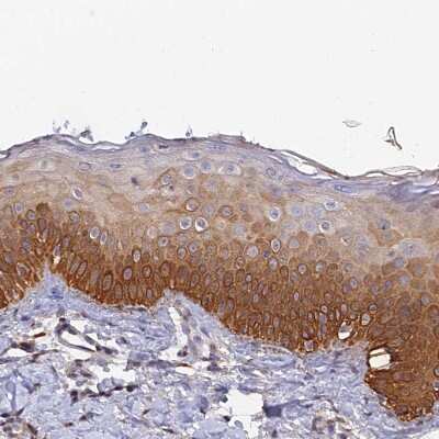 Immunohistochemistry-Paraffin: SLC39A13 Antibody [NBP1-92404] - Staining of human skin shows moderate to strong cytoplasmic positivity in squamous epithelial cells.