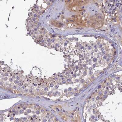 Immunohistochemistry-Paraffin: SLC39A13 Antibody [NBP1-92404] - Staining of human testis shows moderate cytoplasmic positivity in Leydig cells.