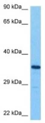 Western Blot: SLC39A13 Antibody [NBP3-10021] - Western blot analysis of SLC39A13 in HCT116 Whole Cell lysates. Antibody dilution at 1.0ug/ml