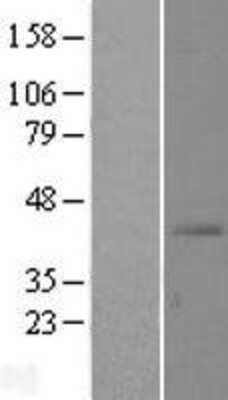 Western Blot: SLC39A13 Overexpression Lysate (Adult Normal) [NBL1-16143] Left-Empty vector transfected control cell lysate (HEK293 cell lysate); Right -Over-expression Lysate for SLC39A13.