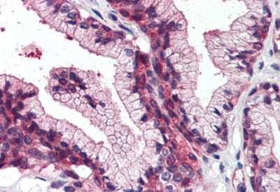 Immunohistochemistry-Paraffin: SLC39A14 Antibody - BSA Free [NBP3-06675] - SLC39A14 Antibody IHC of human prostate. Immunohistochemistry of formalin-fixed, paraffin-embedded tissue after heat-induced antigen retrieval.