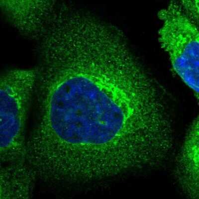 Immunocytochemistry/ Immunofluorescence SLC39A14 Antibody