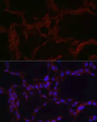 Immunocytochemistry/Immunofluorescence: SLC39A14 Antibody [NBP2-93483] - Immunofluorescence analysis of PC-12 cells using SLC39A14 Rabbit pAb (NBP2-93483) at dilution of 1:100 (40x lens). Blue: DAPI for nuclear staining.