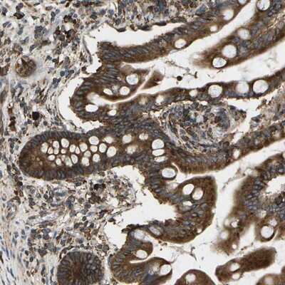Immunohistochemistry-Paraffin: SLC39A14 Antibody [NBP1-81551] - Staining of human small intestine shows strong cytoplasmic positivity in glandular cells.