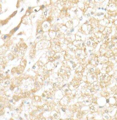 Immunohistochemistry-Paraffin: SLC39A14 Antibody [NBP2-93483] -  Human liver using ZIP14 Rabbit pAb at dilution of 1:50 (40x lens).Perform high pressure antigen retrieval with 10 mM citrate buffer pH 6.0 before commencing with IHC staining protocol.