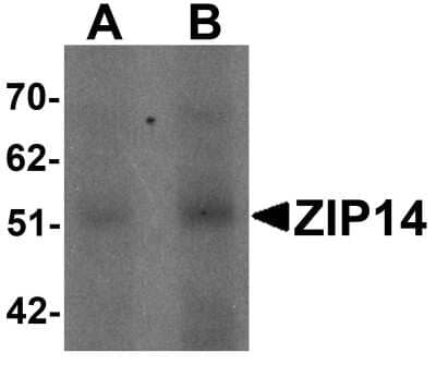 Western Blot SLC39A14 Antibody - BSA Free