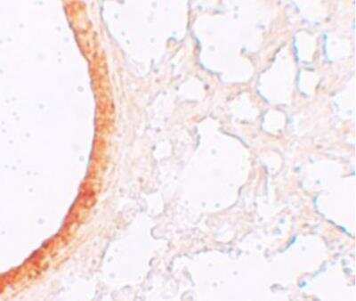 Immunohistochemistry: SLC39A3 Antibody [NBP1-76500] - Lung tissue.