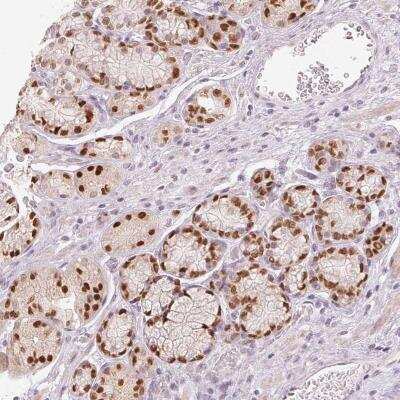 Immunohistochemistry-Paraffin: SLC39A3 Antibody [NBP2-46852] - Staining of human stomach shows strong nuclear positivity in glandular cells.