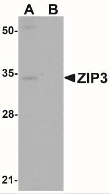 Western Blot SLC39A3 Antibody - BSA Free