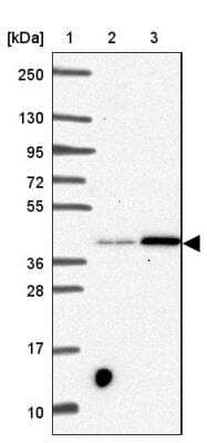 Western Blot SLC39A3 Antibody