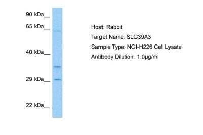 Western Blot: SLC39A3 Antibody [NBP2-88304] - Host: Rabbit. Target Name: SLC39A3. Sample Tissue: Human NCI-H226 Whole Cell lysates. Antibody Dilution: 1ug/ml