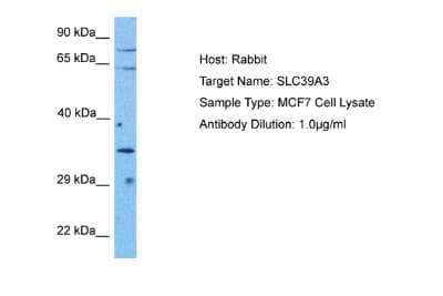 Western Blot: SLC39A3 Antibody [NBP2-88305] - Host: Rabbit. Target Name: SLC39A3. Sample Tissue: Human MCF7 Whole Cell lysates. Antibody Dilution: 1ug/ml