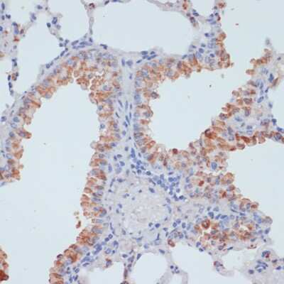 Immunohistochemistry-Paraffin: SLC39A4/ZIP4 Antibody [NBP2-94856] - Mouse lung using SLC39A4 antibody at dilution of 1:100 (40x lens).