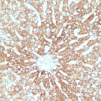 Immunohistochemistry-Paraffin: SLC39A4/ZIP4 Antibody [NBP2-94856] - Rat liver using SLC39A4 antibody t dilution of 1:100 (40x lens). .