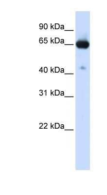 Western Blot: SLC39A4/ZIP4 Antibody [NBP1-59789] - Titration: 0.2-1 ug/ml, Positive Control: Transfected 293T.