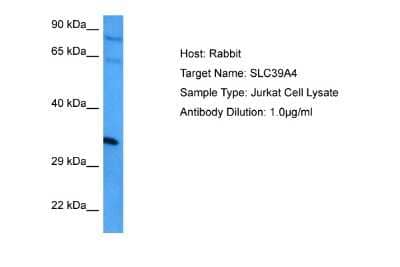 Western Blot: SLC39A4/ZIP4 Antibody [NBP2-82345] - Host: Rabbit. Target Name: SLC39A4. Sample Tissue: Human Jurkat Whole Cell lysates. Antibody Dilution: 1ug/ml